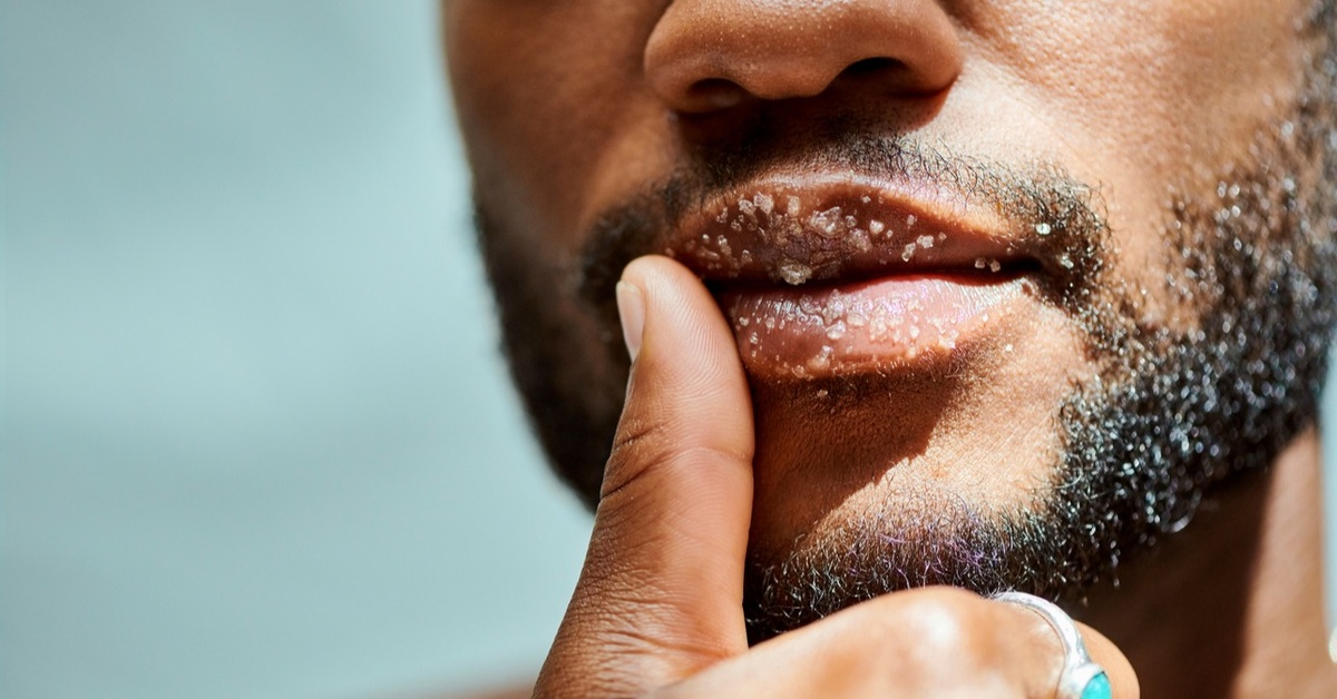 Sephora's BestSelling Lip Scrubs Dailybreak