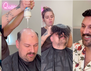 Toupees Are Back — And This Time, Without the Stigma